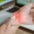 The Most Common Injuries that Drive a Worker and Fitness Fiend to See a Chiropractor