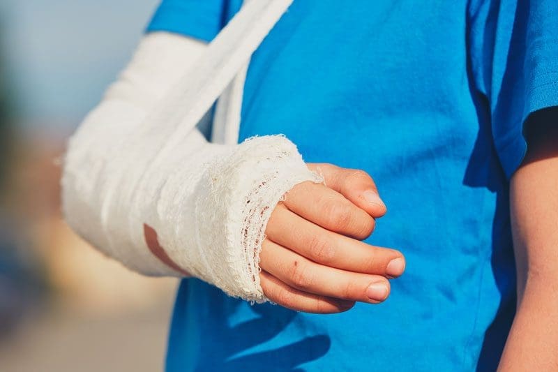 A man with a broken arm in a cast and sling.