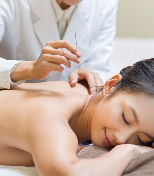 A woman is getting acupuncture therapy after an auto accident
