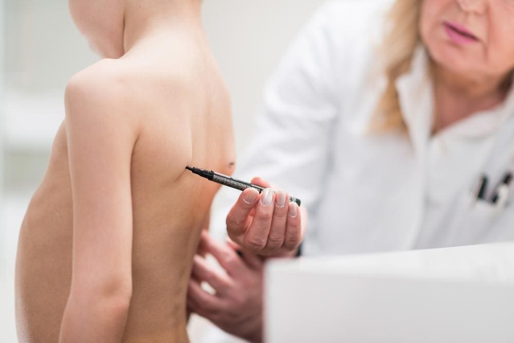 A doctor is checking a child's spine for scoliosis. 