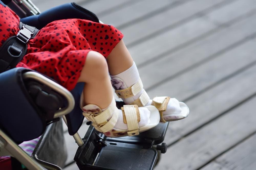 Young girl with cerebral palsy wearing leg braces sitting in wheelchair.