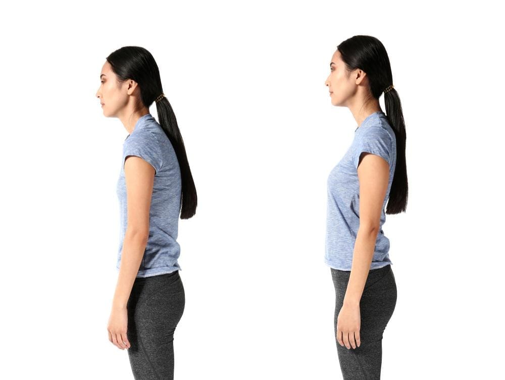 Two images of the same woman standing in profile. In one she has good posture. In the other she has swayback.
