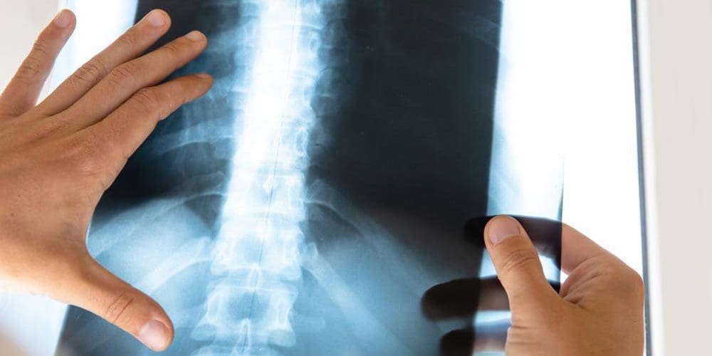 A chiropractor is examining an X-ray of a spine.
