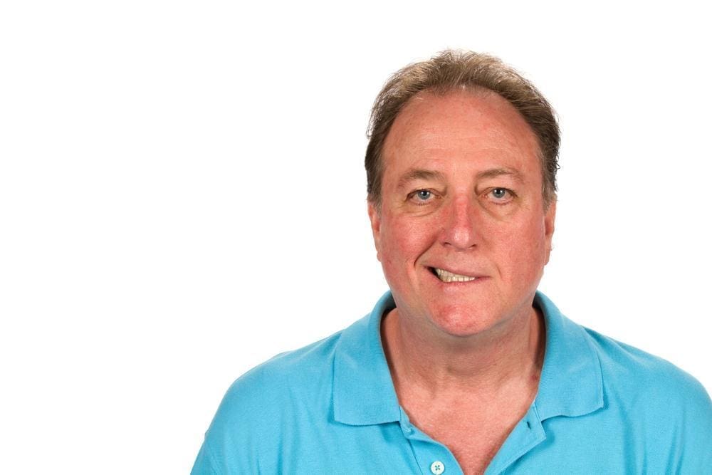 Middle-aged man with facial paralysis from Bell's palsy.
