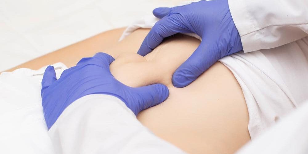 Doctor examining patient with inguinal hernia.