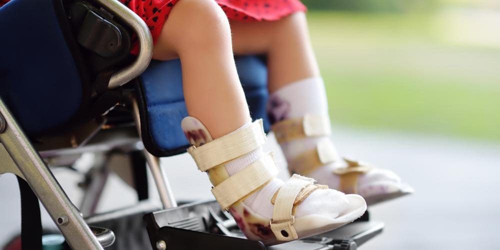 Young girl with cerebral palsy sitting in wheelchair with leg braces.