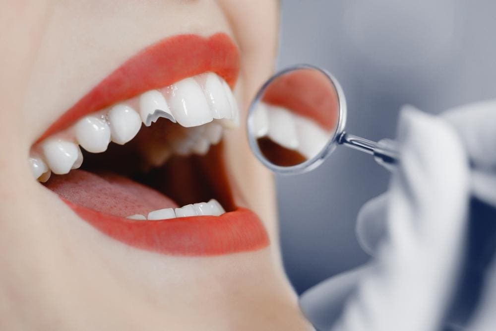 Woman with chipped tooth undergoing dental exam.
