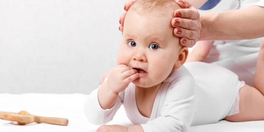 Six-month-old baby receiving chiropractic care for craniosynostosis.