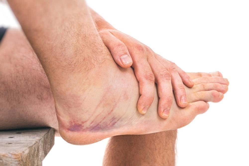 Injured ankle.