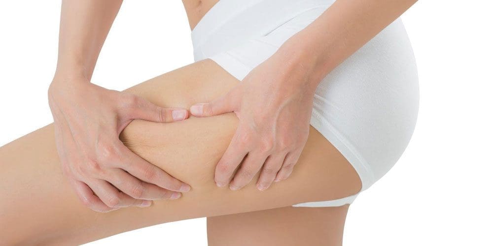 Close-up of a woman holding her thigh due to meralgia paresthetica pain.