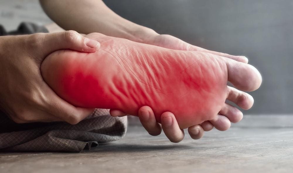 Closeup of a foot with redness indicating burning and tingling.
